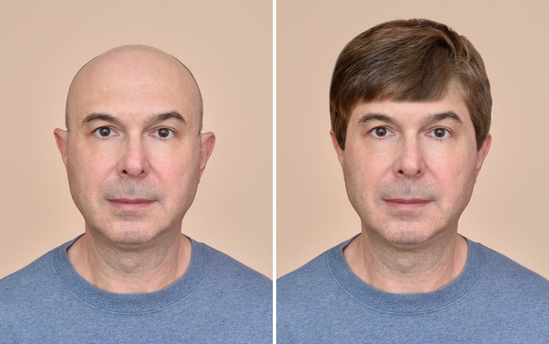 Before and after comparison of a man wearing a men's hair system